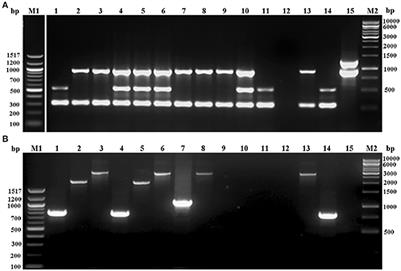 Identification of Major Sequence Types among Multidrug-Resistant Staphylococcus epidermidis Strains Isolated from Infected Eyes and Healthy Conjunctiva